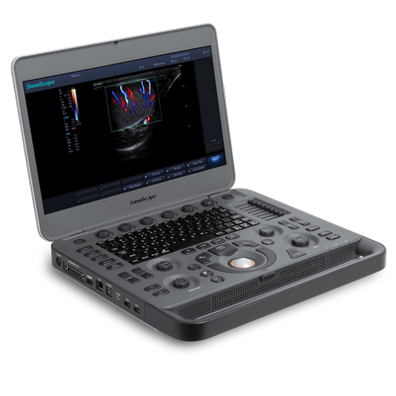 SonoScape X3 Ultralydsscanner