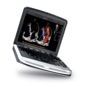 SonoScape P20 Ultralydsscanner