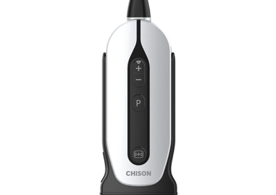 SonoEye P2