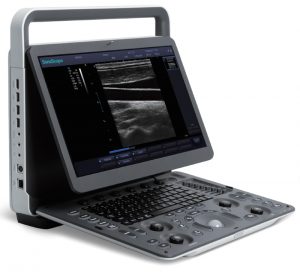 sonoscape_e1_portable_ultrasound