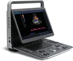 SonoScape E1 Ultralydsscanner